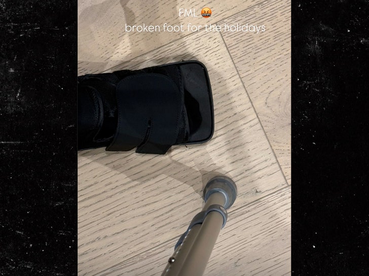 kim kardashian broken foot