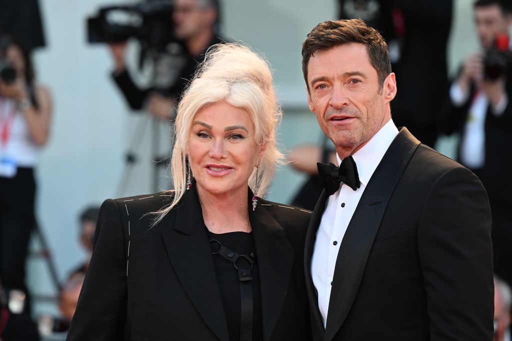 The pair announced their separation in September 2023