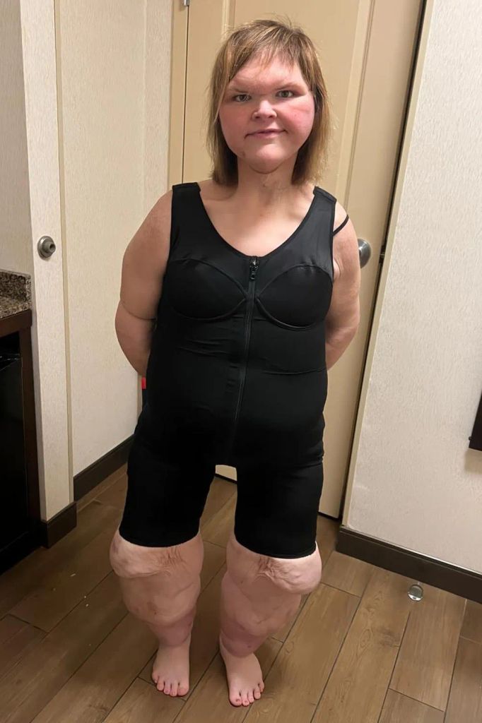 Tammy Slaton showcases her incredible weight loss