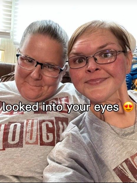 tammy slaton with excess skin removed