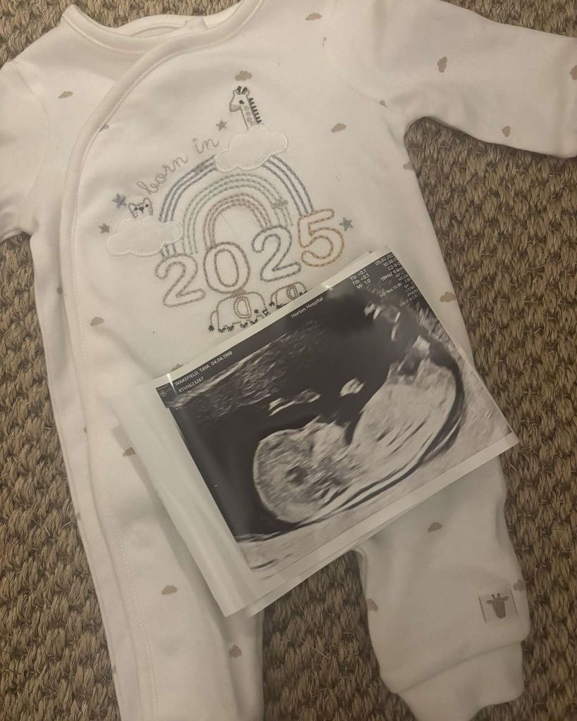 A sonogram image of Kaleb Cooper's child