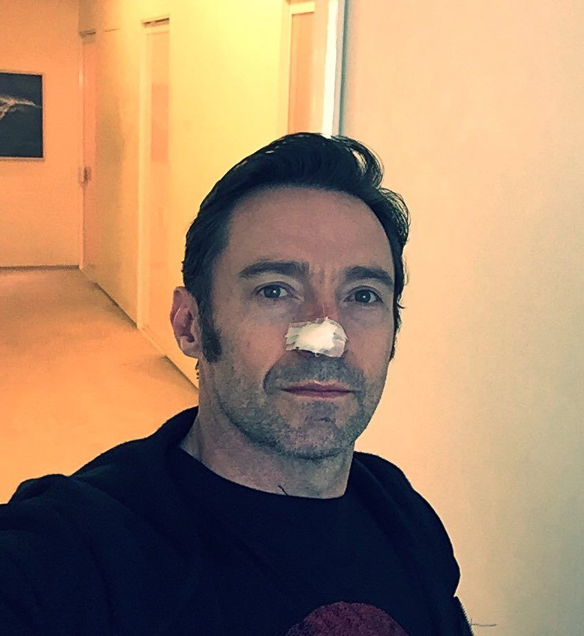 hugh jackman bandaid over nose skin cancers