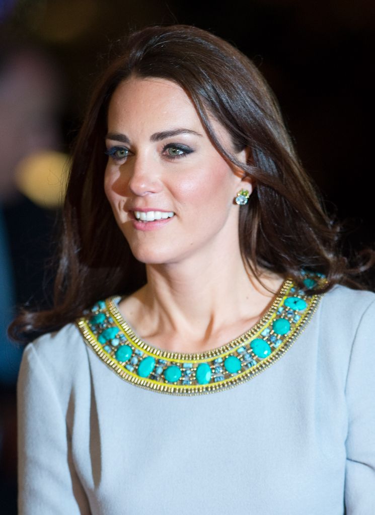Kate's teeth looked slightly different in 2012