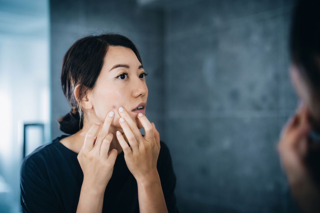 Aggressive acne treatments