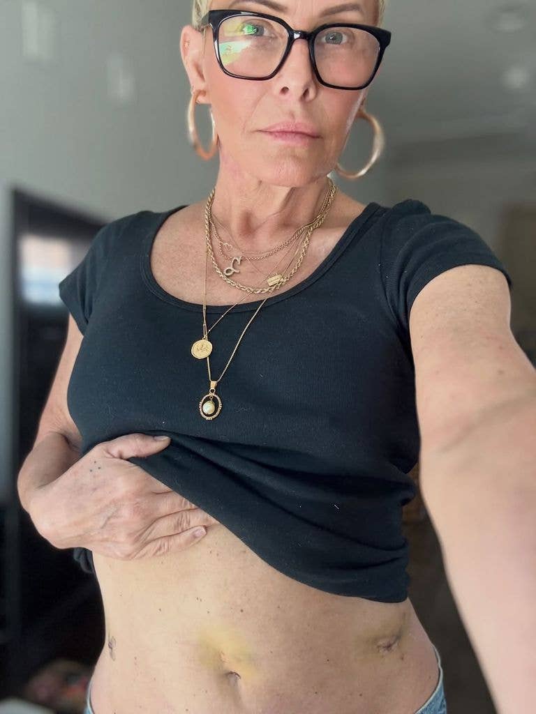 micole eggert menopause