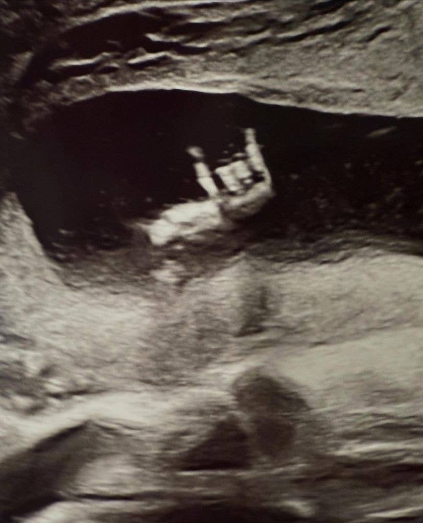 They shared an image from a scan of their unborn child
