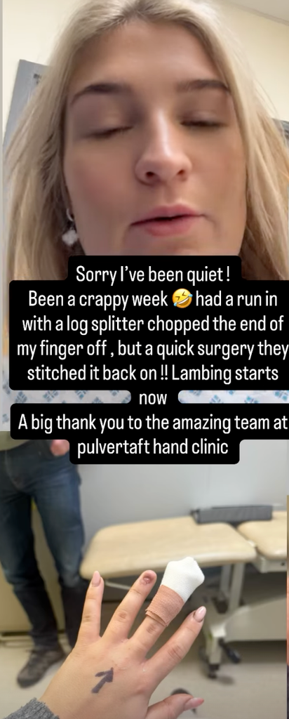 Harriet Cowan reveals gruesome injury