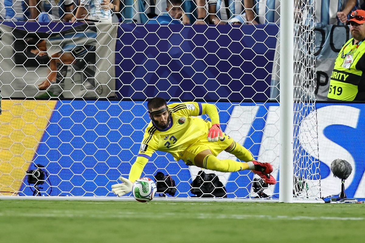 The goalkeeper locked in despite his injury 