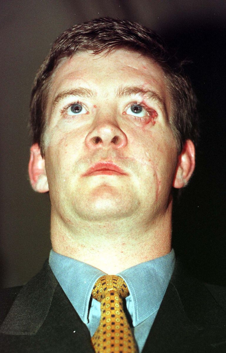 Trevor Rees Jones, who survived the car crash in which Diana The Princess of Wales died, at the Palace de Justice in Paris.