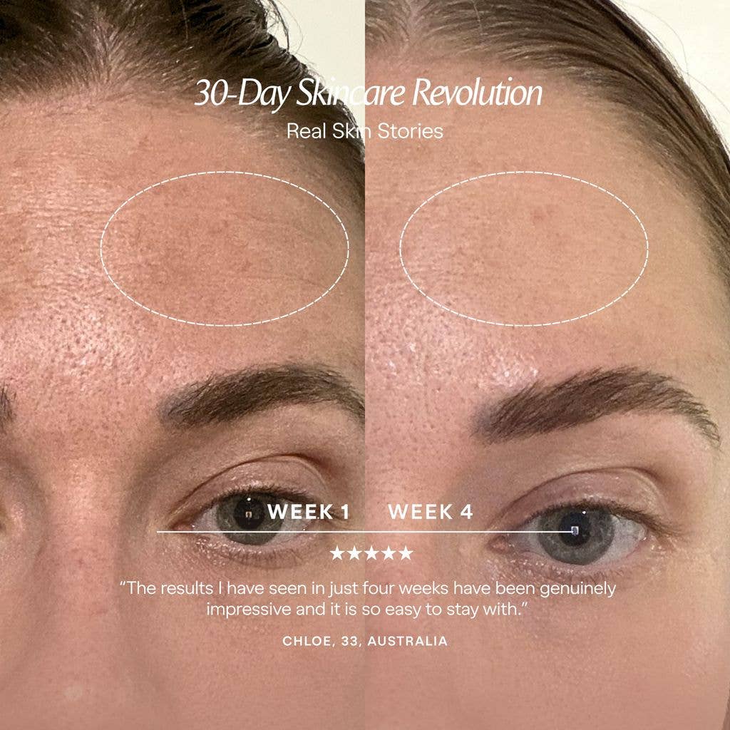 Before and after using Alora Age Renewal LED Light Therapy Panel