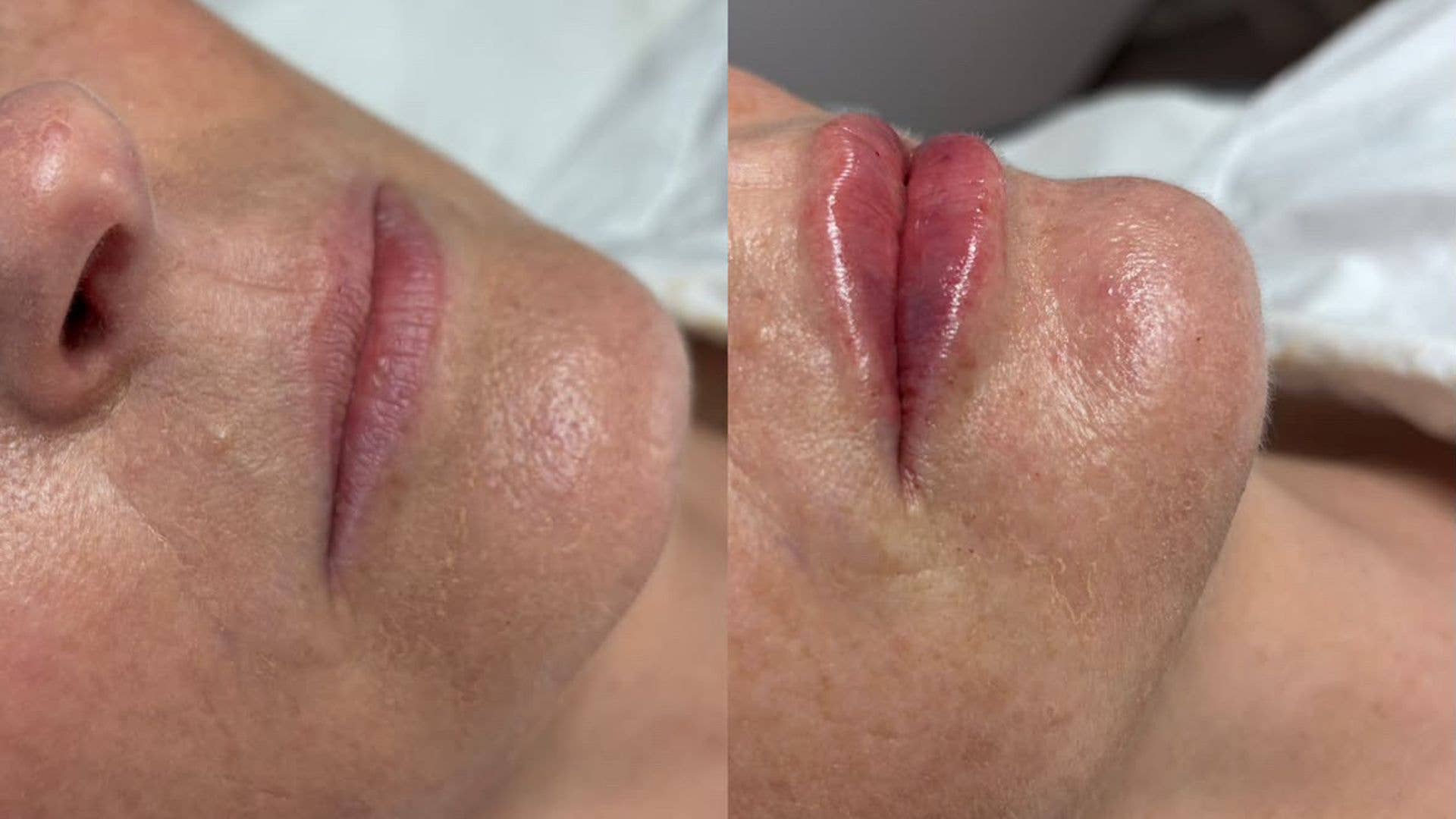 Charley's lips before and immediately after